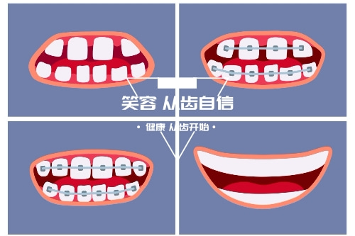 合肥种牙齿比较好的医院